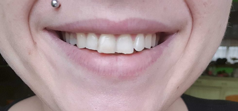 Con Le Unghie E Con I Denti